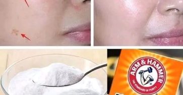 476805639 122134288508567501 3219318306463979449 n 81 215 277 240x300 31 819x1024