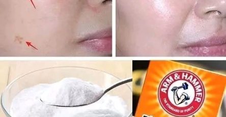 476805639 122134288508567501 3219318306463979449 n 81 215 277 240x300 31 819x1024