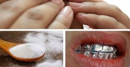 478669558 122155925078364020 7891774500414650537 n