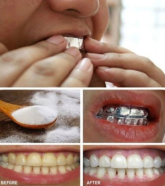 478669558 122155925078364020 7891774500414650537 n