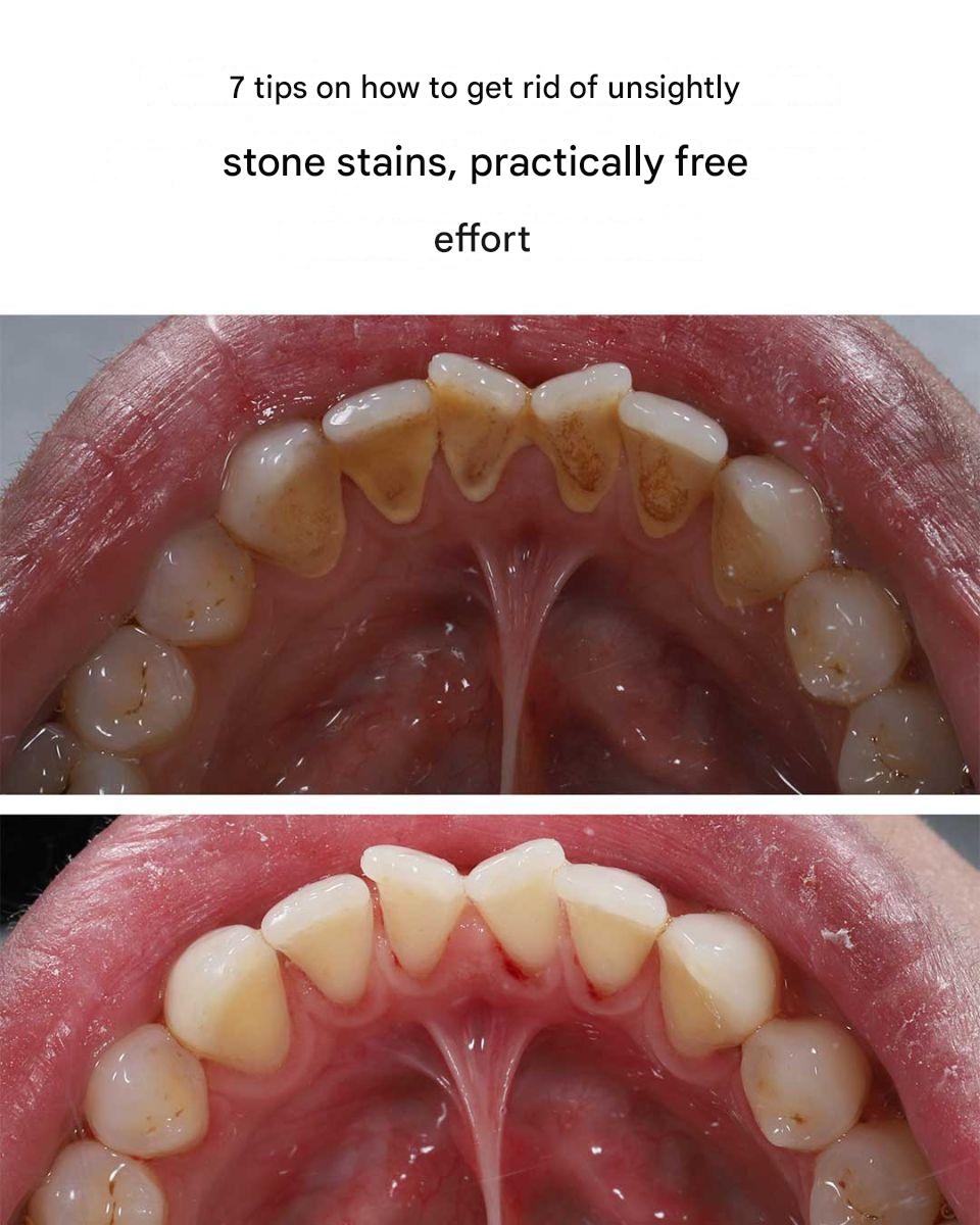 36d29a9d bdf1 4098 91bf f9fc6f25010f