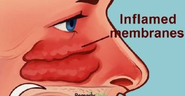 424579890 289046134191418 6334192277646459700 n