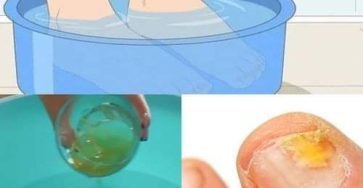 469451754 122109988496631970 4757140382275227739 n 1