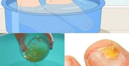 469451754 122109988496631970 4757140382275227739 n 1