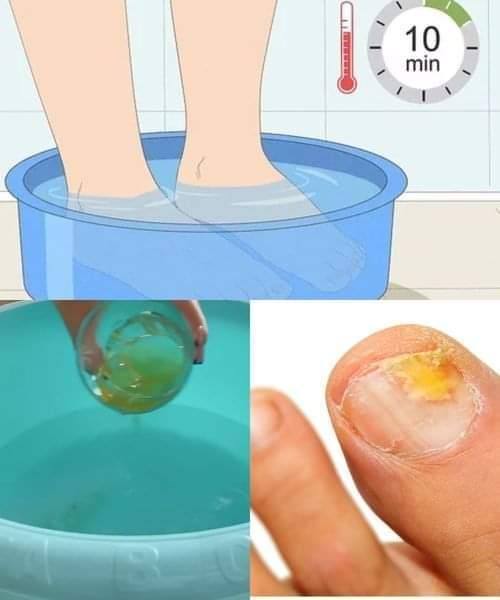 469451754 122109988496631970 4757140382275227739 n 1