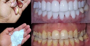 603906927 122155078058940506 323419595253391337 n 768x1024