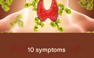 Capture decran 2026 03 05