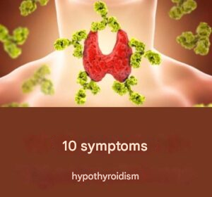 Capture decran 2026 03 05