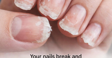 F310695a cacb 48e4 b663 531910925c41