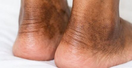 D7e52a29 4eff 44f5 bdcf 2315bbf4a281 220