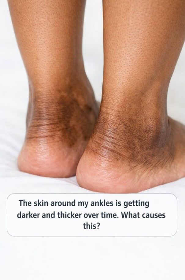 D7e52a29 4eff 44f5 bdcf 2315bbf4a281 220