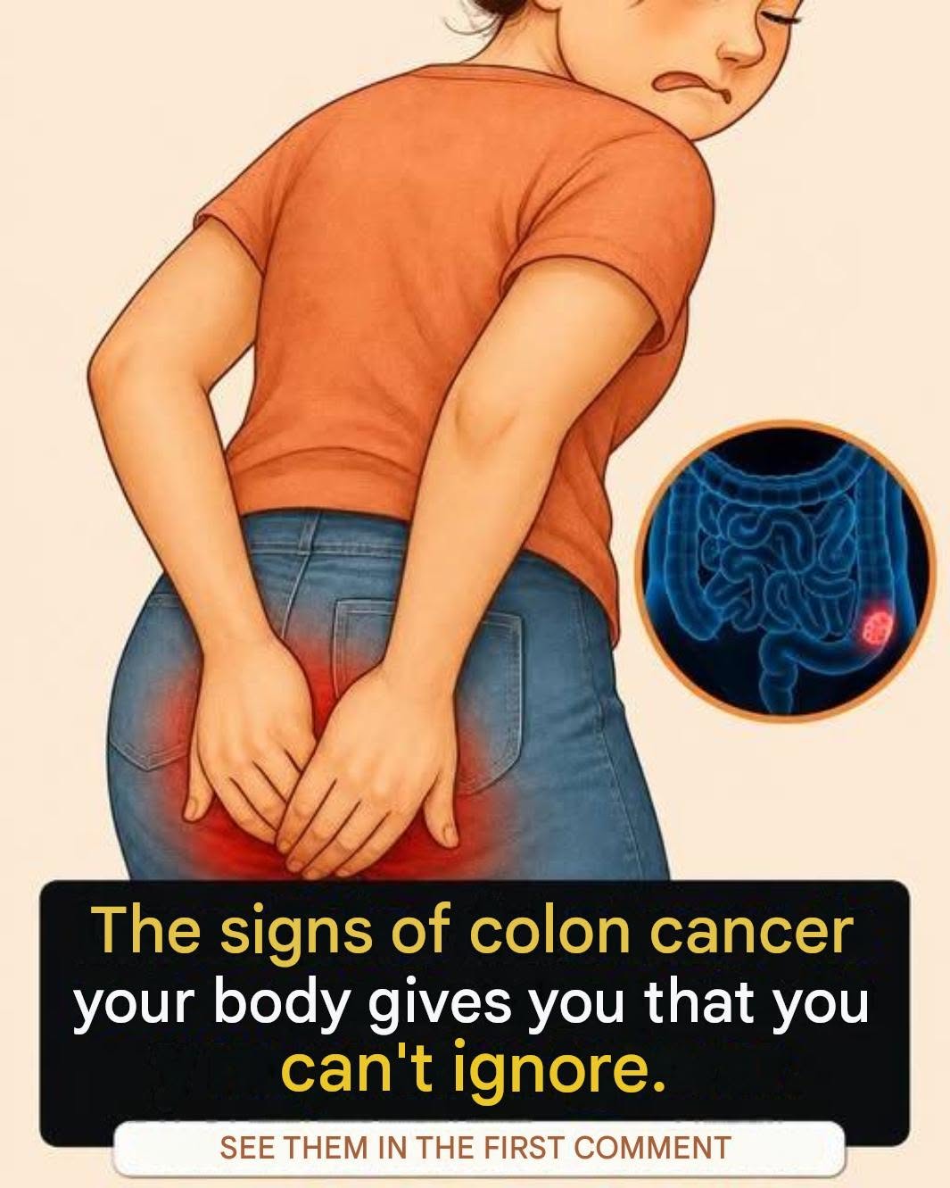 Cqncer